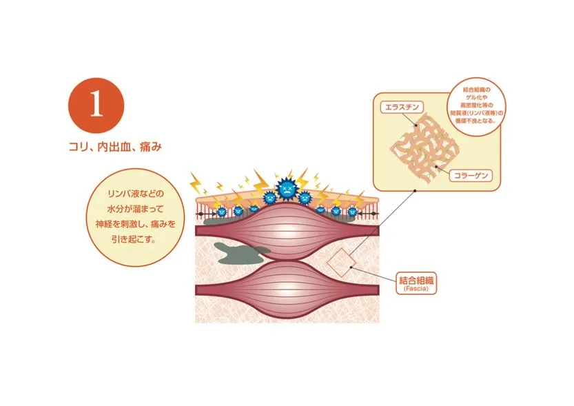 快適な動きを取り戻すためには、体の土台となる筋膜のケアが不可...