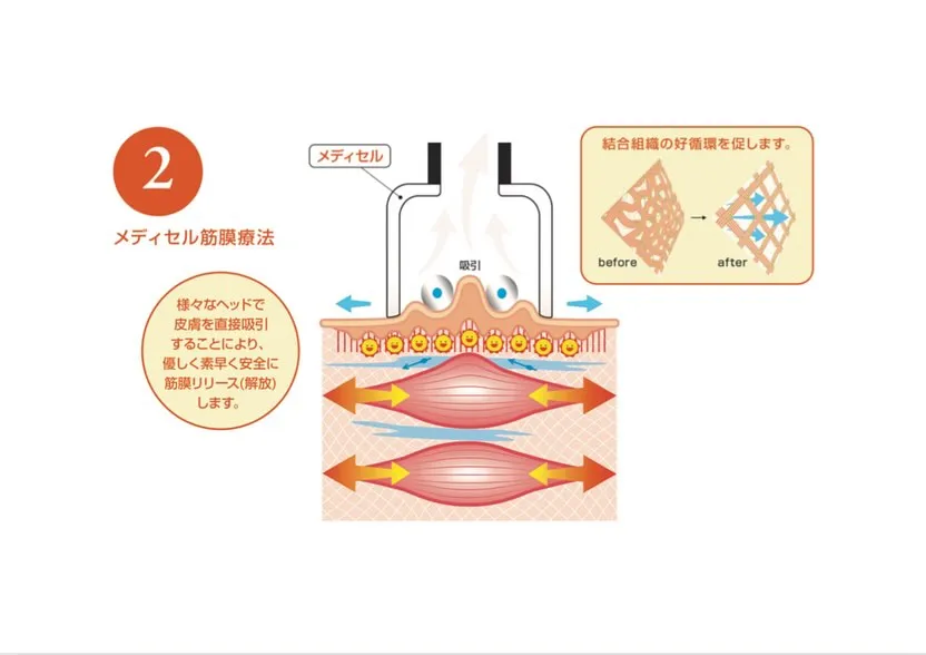 快適な動きを取り戻すためには、体の土台となる筋膜のケアが不可...