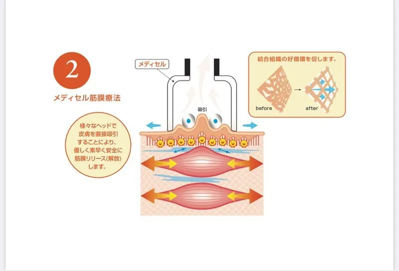 💪✨筋肉がスムーズに動くために、あなたの身体に必要なのは「筋...