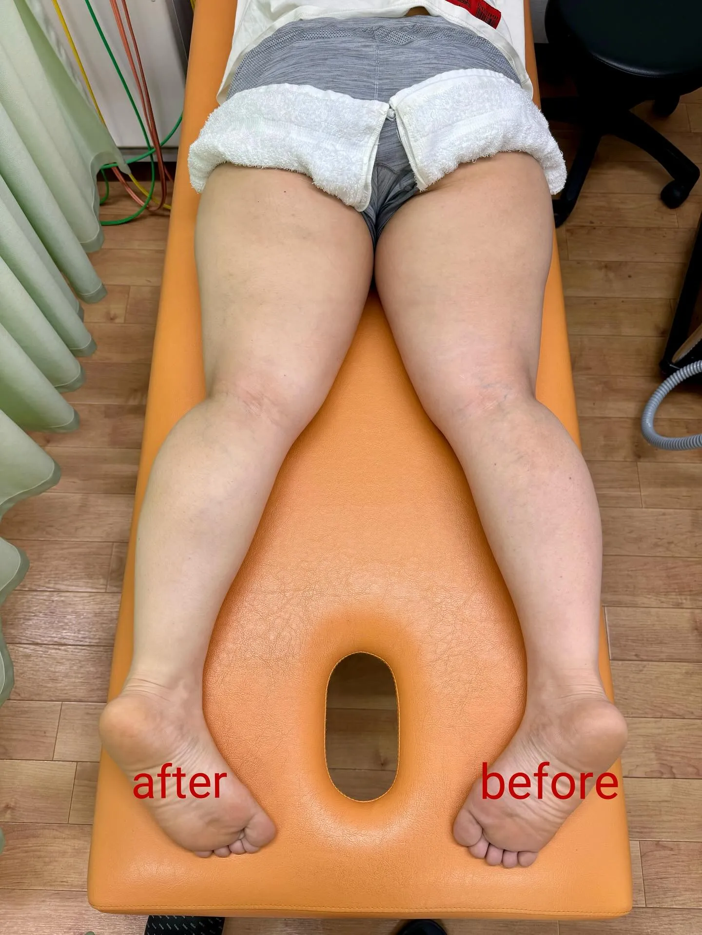 💧【その“むくみ”、放置していませんか?】