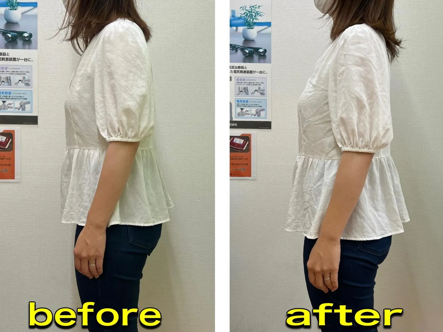 🦴【骨盤のゆがみ＝姿勢のゆがみ⁉】