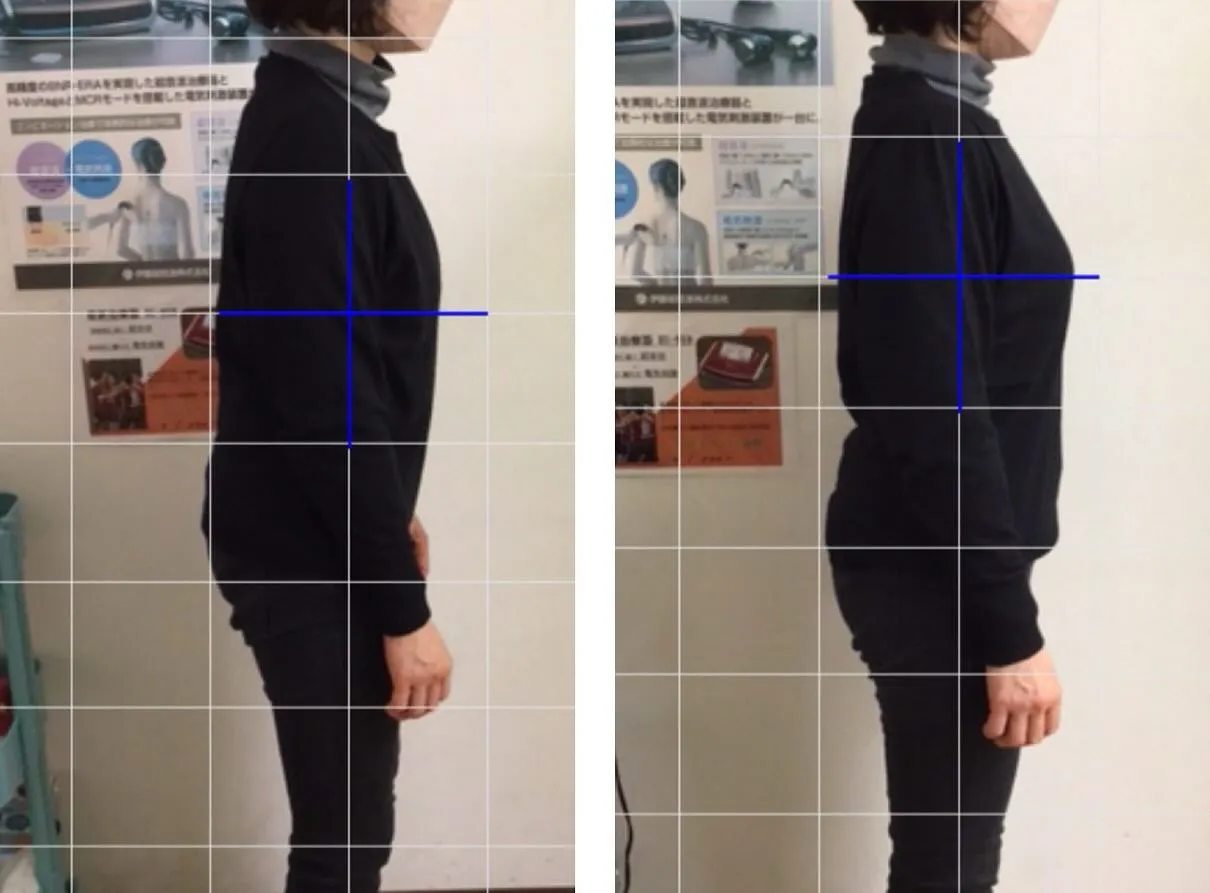 💡【その頭痛、実は“姿勢”が原因かも？】