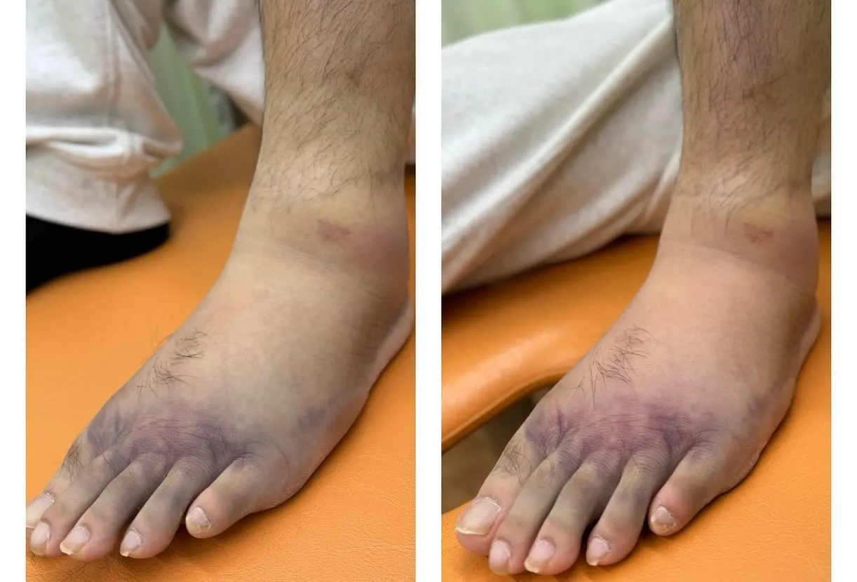 【スポーツ障害を繰り返さないために💡】