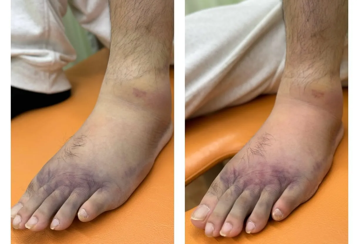 📱スマホやゲーム、長時間の勉強で…