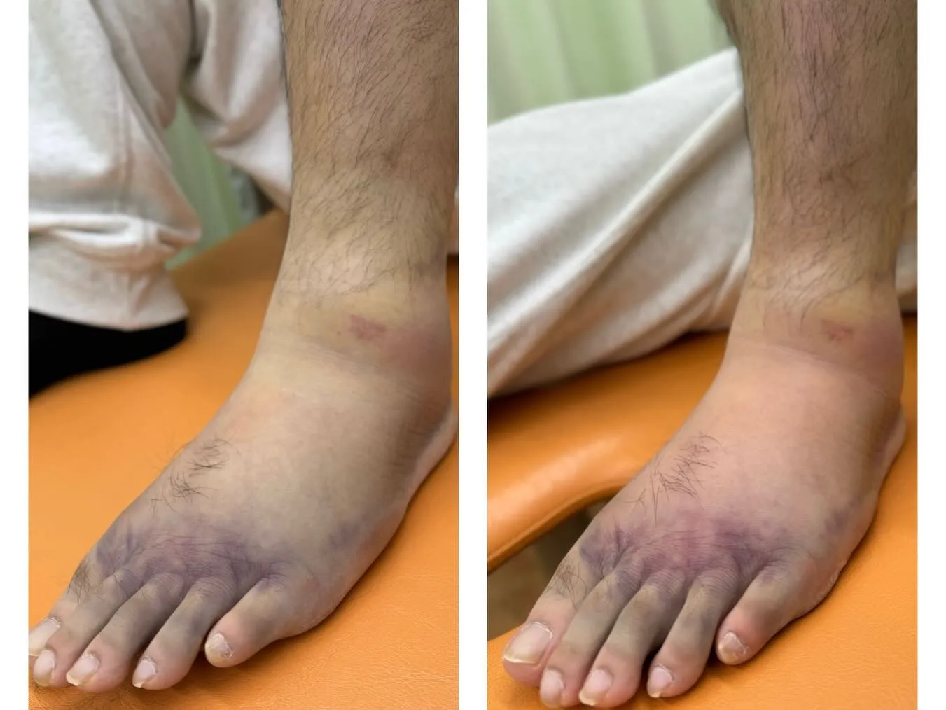 ケガから復帰しても、