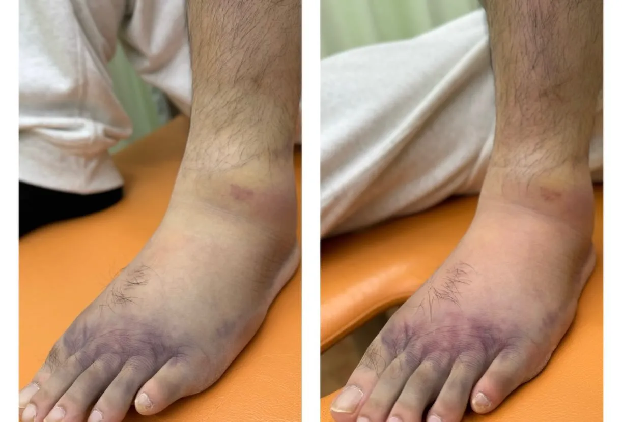 筋トレはしているのに…😣