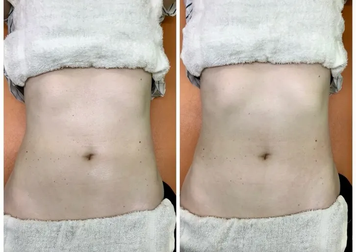 「体重は戻ったのに、体型が戻らない…😣」