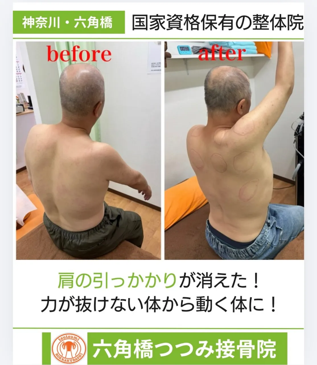 肩の引っかかりが消えた!